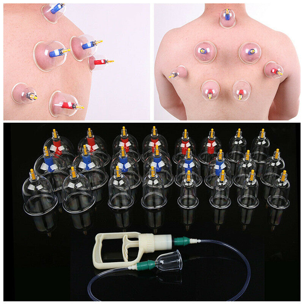 Therapeutic Cupping Set