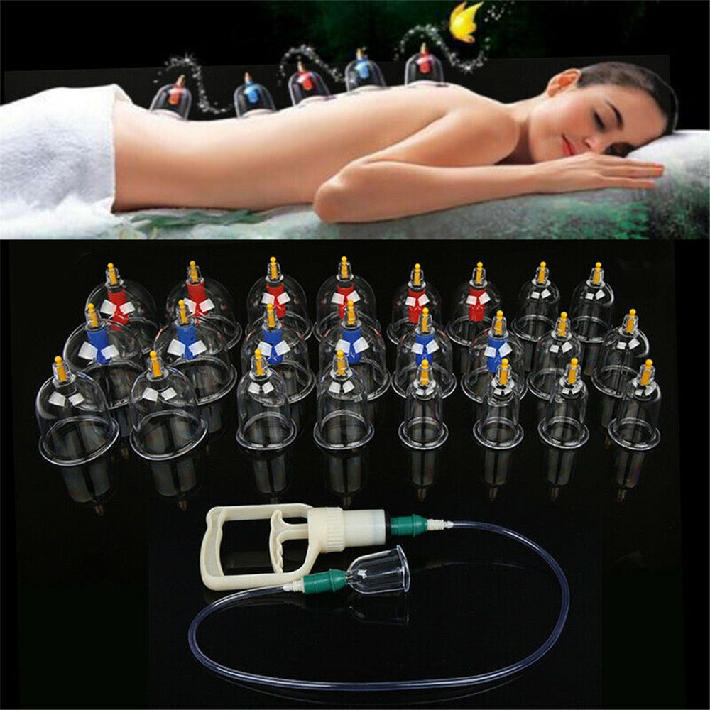 Therapeutic Cupping Set